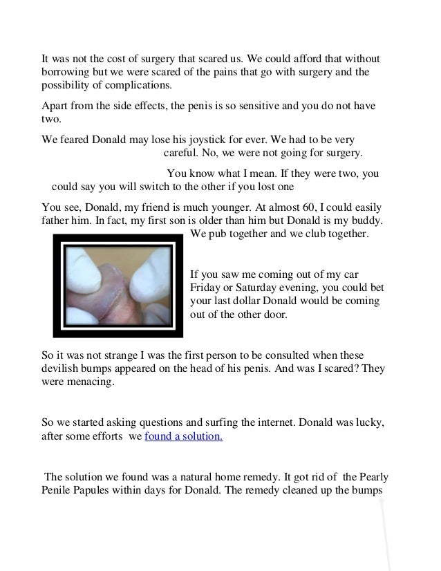 How To Take in Rid Of Perlaceous Penile Papules Naturally How To Be Rid Of Mother-of-pearl Penile Papules Naturally